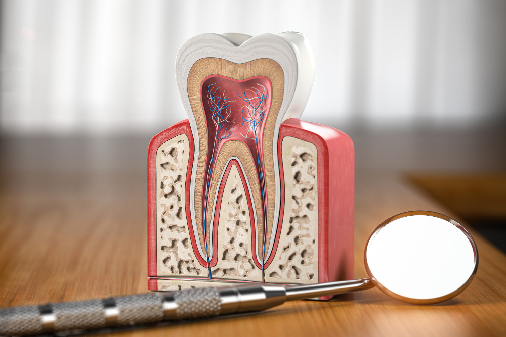 Root Canals 